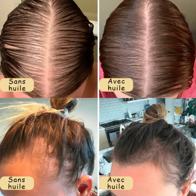 Huile Végétale pour Cheveux - Boost'Hair™-Huile pour Cheveux-