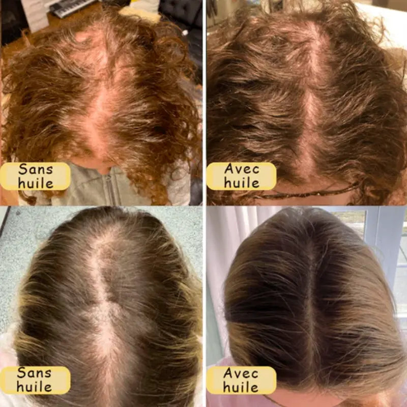 Huile Végétale pour Cheveux - Boost'Hair™-Huile pour Cheveux-