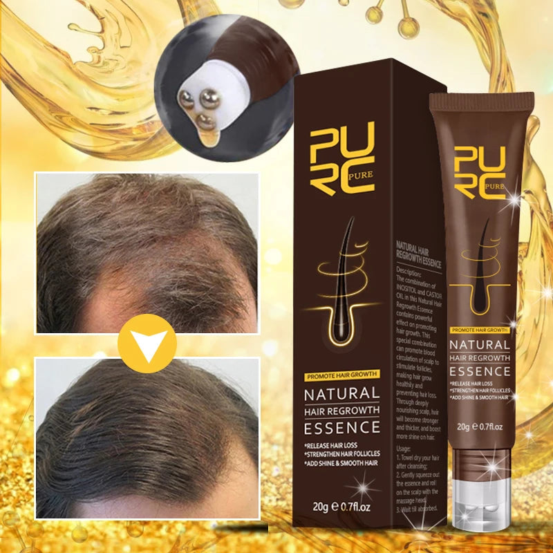 Sérum Repousse Cheveux au Gingembre - Pure-Sérum pour Cheveux-