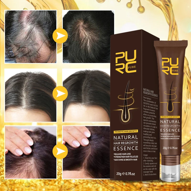 Sérum Repousse Cheveux au Gingembre - Pure-Sérum pour Cheveux-