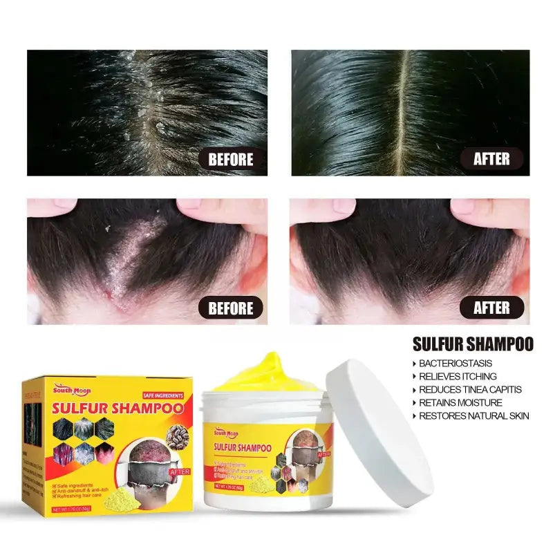 Shampoing au Soufre - Okeny-Shampoing pour Cheveux-