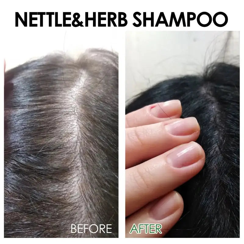 Shampoing aux Orties & Herbes - Eelhoe-Shampoing pour Cheveux-